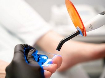 Установка титановой нити Установка титановой нити
